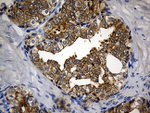 CIB1 Antibody in Immunohistochemistry (Paraffin) (IHC (P))