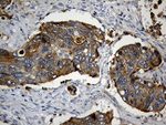 CIB1 Antibody in Immunohistochemistry (Paraffin) (IHC (P))