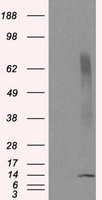 CISD1 Antibody in Western Blot (WB)