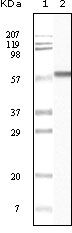 CK1 alpha Antibody in Western Blot (WB)