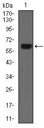 Cytokeratin 5 Antibody in Western Blot (WB)