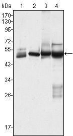 Cytokeratin 7 Antibody in Western Blot (WB)