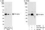 CKI alpha Antibody in Western Blot (WB)