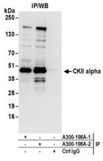 CKII alpha Antibody in Western Blot (WB)