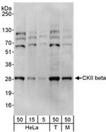 CKII beta Antibody in Western Blot (WB)