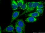 FIS1 Antibody in Immunocytochemistry (ICC/IF)