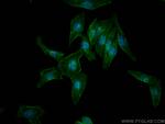 Septin 2 Antibody in Immunocytochemistry (ICC/IF)