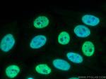 FUS/TLS Antibody in Immunocytochemistry (ICC/IF)