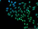 FUS/TLS Antibody in Immunocytochemistry (ICC/IF)