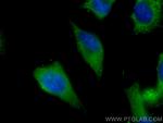 PPP3CA Antibody in Immunocytochemistry (ICC/IF)