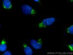 TGN46 Antibody in Immunocytochemistry (ICC/IF)