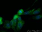 CEP63 Antibody in Immunocytochemistry (ICC/IF)