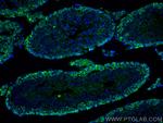 C9orf72 Antibody in Immunohistochemistry (PFA fixed) (IHC (PFA))