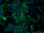 ANK3 Antibody in Immunocytochemistry (ICC/IF)