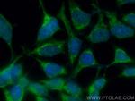 USP9X Antibody in Immunocytochemistry (ICC/IF)