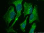 KEAP1 Antibody in Immunocytochemistry (ICC/IF)