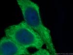 ATF4 Antibody in Immunocytochemistry (ICC/IF)