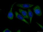 RRM1 Antibody in Immunocytochemistry (ICC/IF)