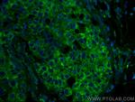 RRM1 Antibody in Immunohistochemistry (PFA fixed) (IHC (PFA))