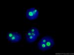 B23/NPM1 Antibody in Immunocytochemistry (ICC/IF)