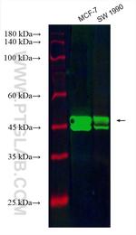 ESR2 Antibody in Western Blot (WB)