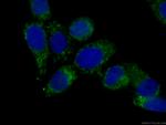 peroxiredoxin 2 Antibody in Immunocytochemistry (ICC/IF)