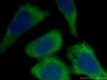 AKT Antibody in Immunocytochemistry (ICC/IF)