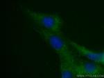 Myosin Light Chain 2 Antibody in Immunocytochemistry (ICC/IF)