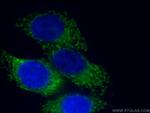 HADHA Antibody in Immunocytochemistry (ICC/IF)