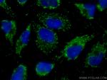 Napsin A Antibody in Immunocytochemistry (ICC/IF)