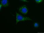 PKM2-specific Antibody in Immunocytochemistry (ICC/IF)