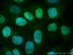 P53 Antibody in Immunocytochemistry (ICC/IF)