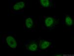 U2AF35 Antibody in Immunocytochemistry (ICC/IF)