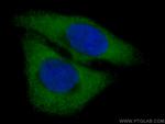 GOT1 Antibody in Immunocytochemistry (ICC/IF)