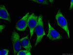 HSP90 Antibody in Immunocytochemistry (ICC/IF)