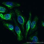 Vimentin Antibody in Immunocytochemistry (ICC/IF)