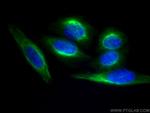 Vimentin Antibody in Immunocytochemistry (ICC/IF)