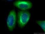 Vimentin Antibody in Immunocytochemistry (ICC/IF)