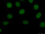 Transketolase Antibody in Immunocytochemistry (ICC/IF)