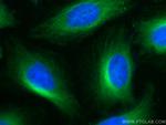 alpha Tubulin Antibody in Immunocytochemistry (ICC/IF)