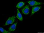 RPS3 Antibody in Immunocytochemistry (ICC/IF)