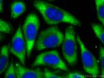 Albumin Antibody in Immunocytochemistry (ICC/IF)