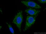 Albumin Antibody in Immunocytochemistry (ICC/IF)