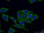 14-3-3 Antibody in Immunocytochemistry (ICC/IF)