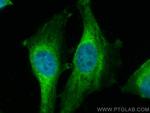 UBE2C Antibody in Immunocytochemistry (ICC/IF)