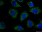 Fetuin-A Antibody in Immunocytochemistry (ICC/IF)