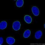 Lamin B1 Antibody in Immunocytochemistry (ICC/IF)