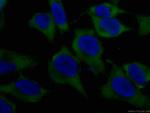 RAC1 Antibody in Immunocytochemistry (ICC/IF)