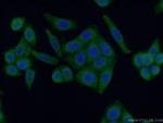 ARG1 Antibody in Immunocytochemistry (ICC/IF)