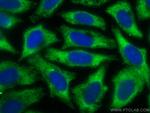 Alpha-1-Antitrypsin Antibody in Immunocytochemistry (ICC/IF)